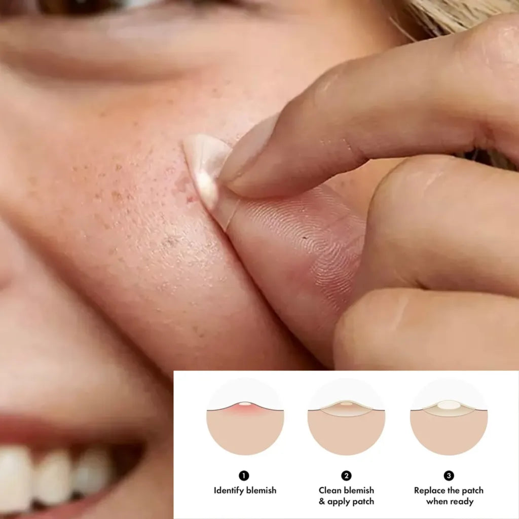 Hydrocolloid Pimple Patches (96 ct) — view 3